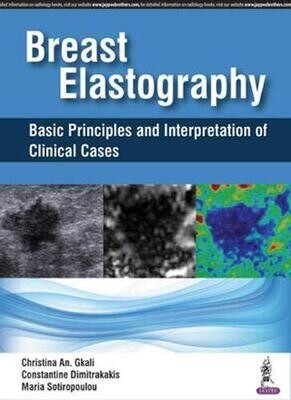 Breast Elastography: Basic Principles and Interpretation of Clinical Cases
1st Edition