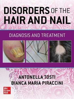Disorders of the Hair and Nail: Diagnosis and Treatment
1st Edition