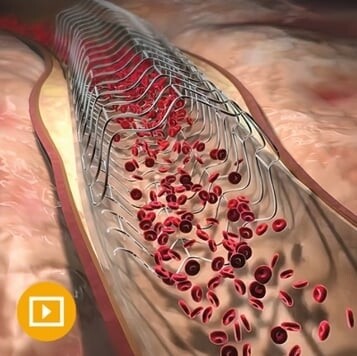 Comprehensive Review of Interventional Cardiology 2023 Oakstone Video Lectures (34 Videos + 2 Pdfs)