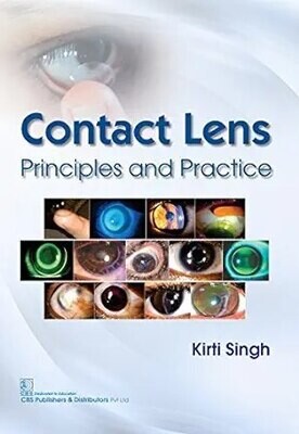 Contact Lens Principles and Practice (Modern System of Ophthalmology (MSO) Series)