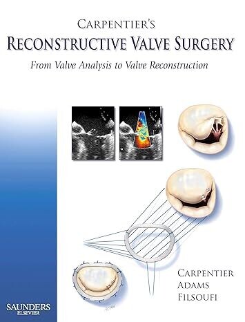Carpentier&#39;s Reconstructive Valve Surgery 1st Edition