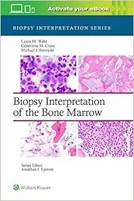 Biopsy interpretation of the Bone marrow