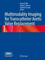 Multimodality imaging for transcatheter aortic valve replacement