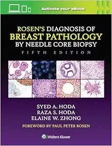Rosen’s Diagnosis of Breast Pathology by Needle Core Biopsy, 5th edition 2023