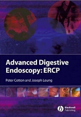Advanced digestive endoscopy: ERCP