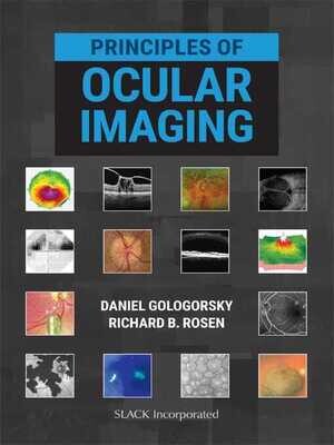 Principles of Ocular Imaging
1st edition