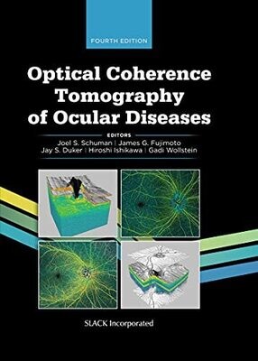 Optical Coherence Tomography of Ocular Diseases, 4th Edition