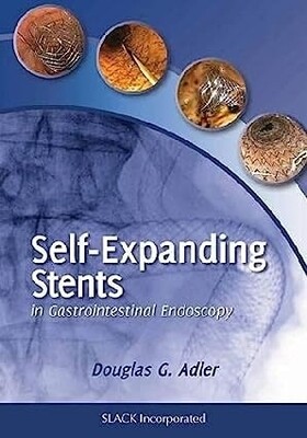 Self-Expanding Stents in Gastrointestinal Endoscopy 2023