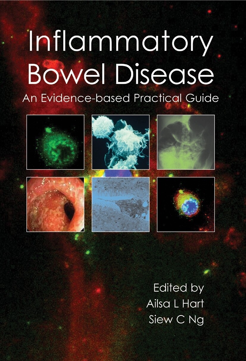 Inflammatory bowel disease An Evidence-Based Practical Guide