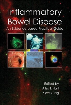 Inflammatory bowel disease An Evidence-Based Practical Guide