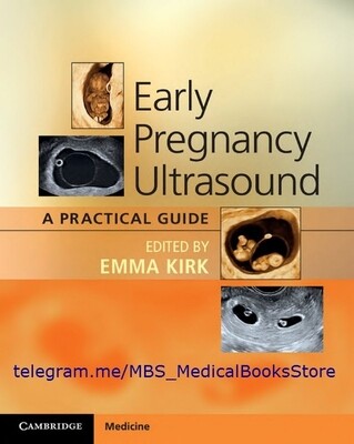Early Pregnancy Ultrasound a practical guide