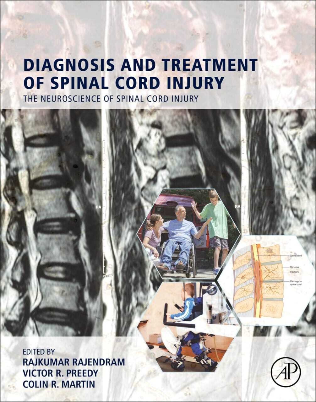 Diagnosis and Treatment of Spinal Cord injury
