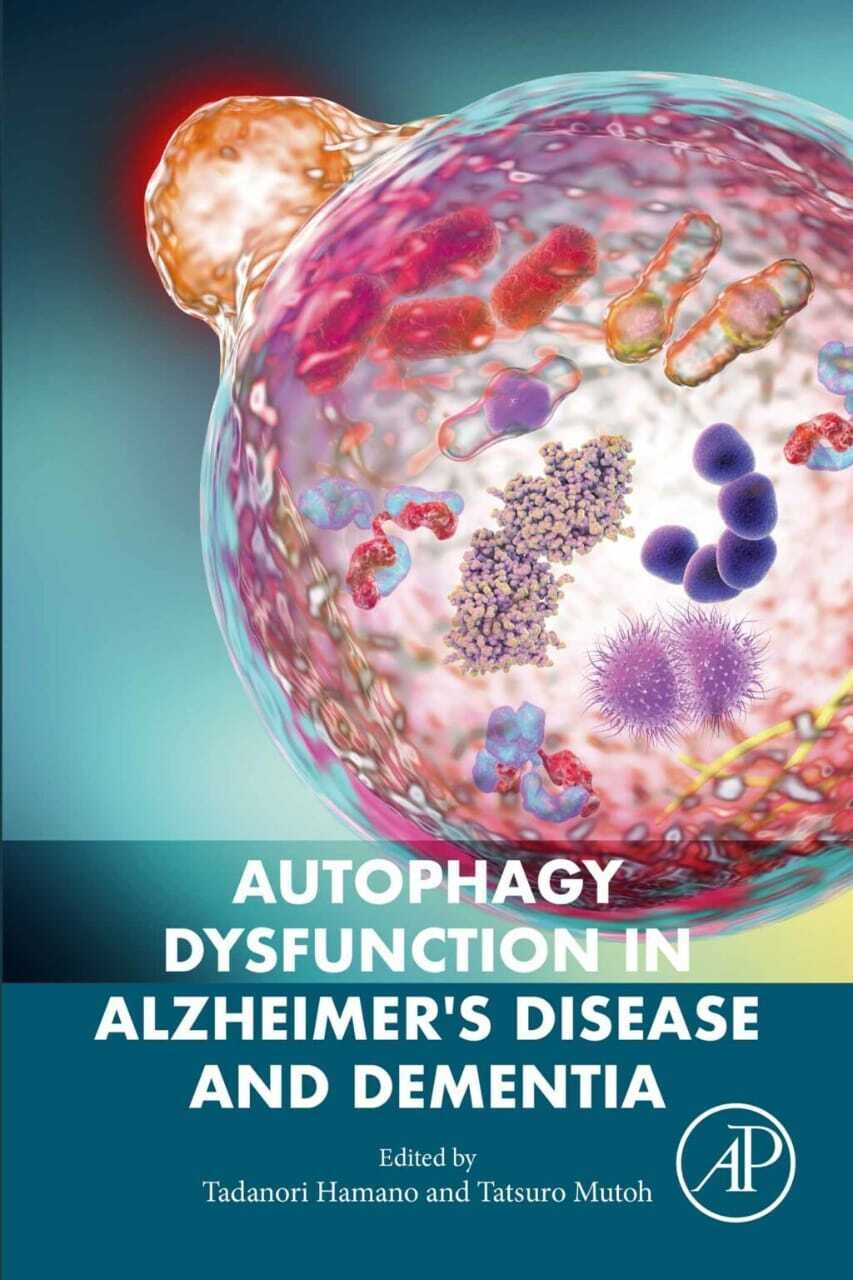 Autophagy Dysfunction in Alzheimer&#39;s Disease and Dementia