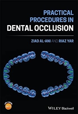 Practical procedures in dental occlusion