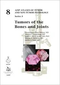 Tumors Of The Bones And Joints (AFIP Atlases Of Tumor And Non-Tumor Pathology, Series 5, Volume 8)