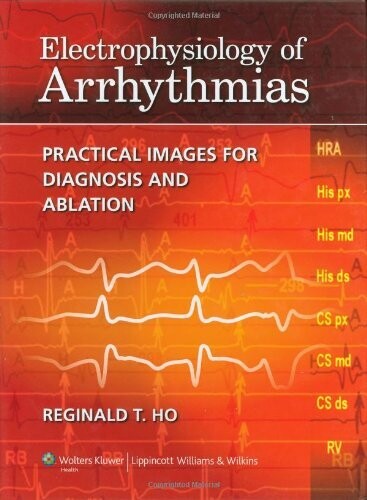 Electrophysiology Of Arrhythmias: Practical Images For Diagnosis And Ablation (EPUB)