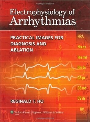 Electrophysiology Of Arrhythmias: Practical Images For Diagnosis And Ablation (EPUB)