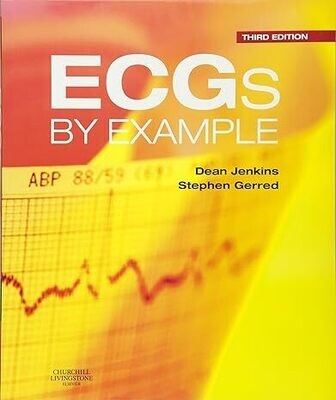 ECGs by Example 3rd Edition