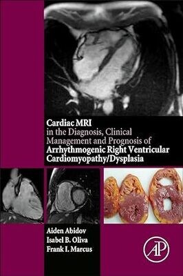 Cardiac MRI in Diagnosis, Clinical Management, and Prognosis of Arrhythmogenic Right Ventricular Cardiomyopathy/Dysplasia 1st Edition