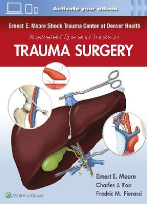 Ernest E. Moore Shock Trauma Center at Denver Health Illustrated Tips and Tricks in Trauma Surgery