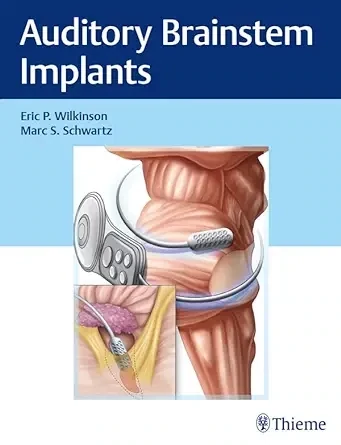 Auditory Brainstem Implants (EPUB)