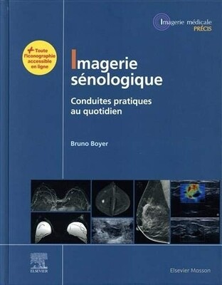 Imagerie Sénologique: Conduites Pratiques Au Quotidien (Imagerie Médicale : Précis) (French Edition)