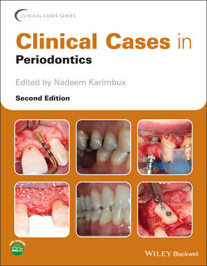 Clinical Cases in Periodontics, 2nd Edition(EPUB)