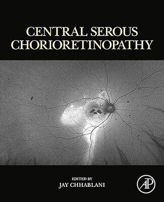 Central Serous Chorioretinopathy 1st Edition