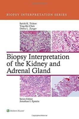 Biopsy Interpretation Of The Kidney &amp; Adrenal Gland (Biopsy Interpretation Series)