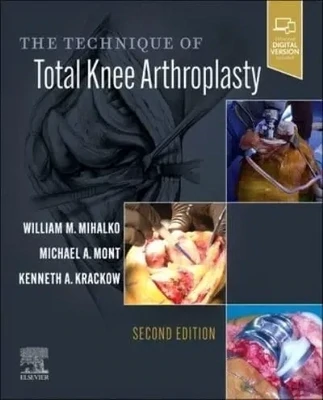 The Technique of Total Knee Arthroplasty (EPUB)