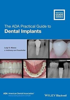 The ADA Practical Guide to Dental Implants 1st Edition
