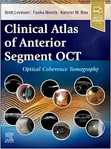 Clinical Atlas Of Anterior Segment OCT: Optical Coherence Tomography