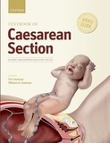 Textbook Of Caesarean Section