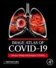 Image Atlas of Covid-19