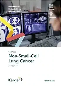 Fast Facts: Non-Small-Cell Lung Cancer, 2nd Edition