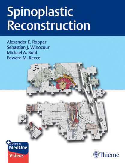 SPINOPLASTIC RECONSTRUCTION