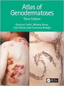 Atlas Of Genodermatoses 3rd Edition 2024