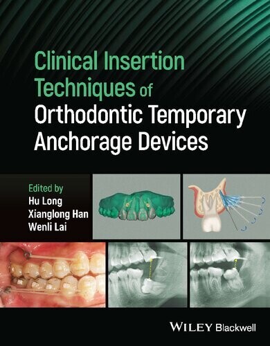 Clinical Insertion Techniques of Orthodontic Temporary Anchorage Devices 1st Edition