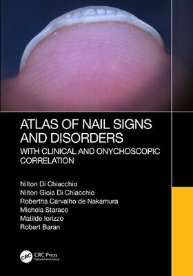 Atlas of Nail Signs and Disorders with Clinical and Onychoscopic Correlation 1st Edition