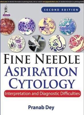 Fine Needle Aspiration Cytology: Interpretation And Diagnostic Difficulties, 2nd Edition