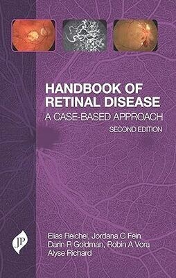 Handbook of Retinal Disease: A Cased-Based Approach 2nd Edition