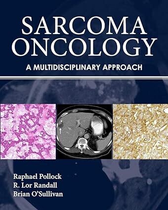 Sarcoma Oncology: A Multidisciplinary Approach