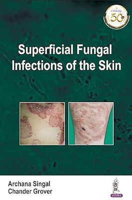 Superficial Fungal Infections of the Skin 1st Edition