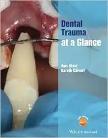 Dental Trauma At A Glance