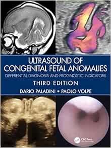 Ultrasound of Congenital Fetal Anomalies: Differential Diagnosis and Prognostic Indicators 3rd Edition
