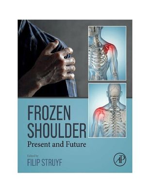 Frozen Shoulder: Present and Future