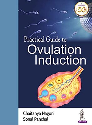 Practical Guide To Ovulation Induction