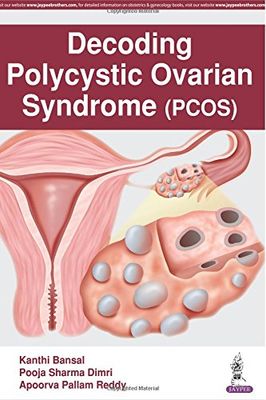 Decoding Polycystic Ovarian Syndrome (PCOS)