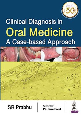 Clinical Diagnosis In Oral Medicine: A Case-Based Approach