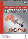 Mastering The Techniques In Hysteroscopy